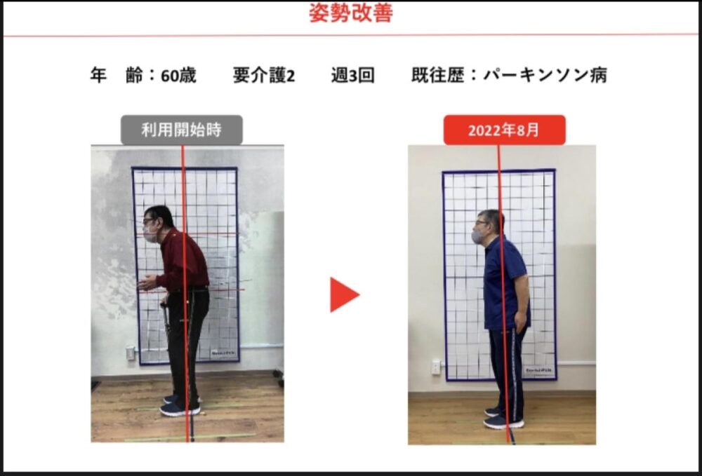 喜びの声【脚が軽くなって、元気に夕食の支度ができます!】